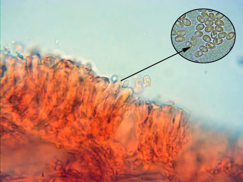 Calocybe onychina 10 - Basidio x 1000